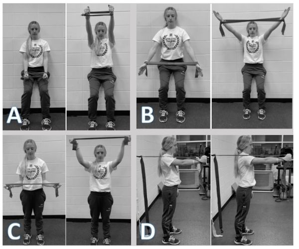Fig 1 — Scapular fixation MWM